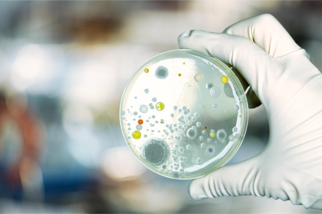 Gloved hand holding petri dish showing germs and bacteria growth